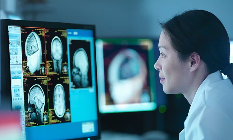 alt=neuroscientist examining a scan of a human's brain on a computer
