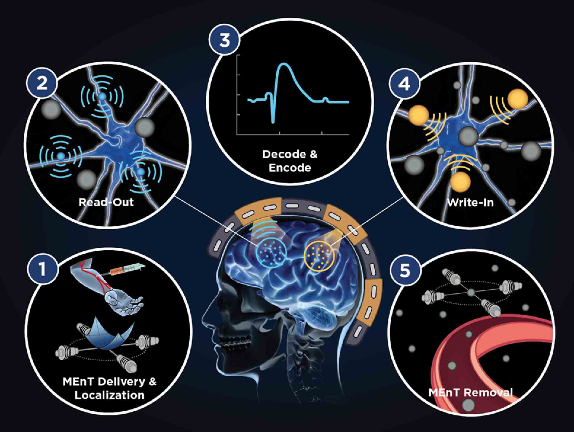 Photo: Image depicting the working process of Neuralife