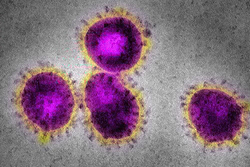 Emerging Infectious Diseases