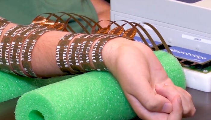 alt= close up of the battelle neurobridge technology on a person's arm