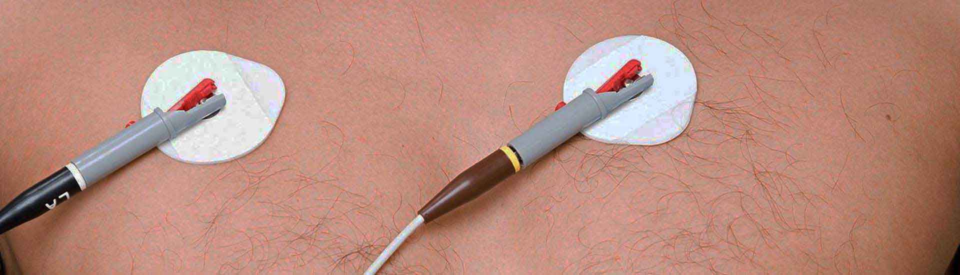 Photo: Electrodes which prevent skin abrasion