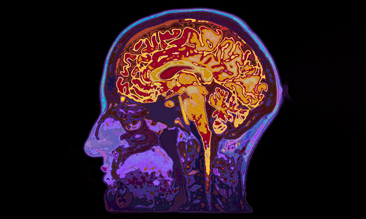 Photo: Brain showing different areas