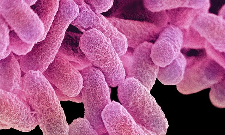 Photo: Microscopic image of a virus