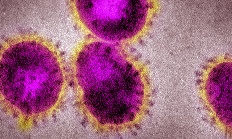Photo: Microscopic image of COVID-19 virus