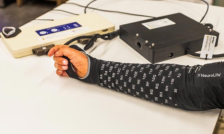 alt: the wearable neurolife sleeve being worn by a person affected by a spinal cord injury caused by a stroke.