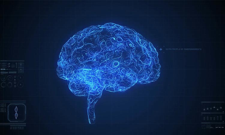 Photo: scan of a brain