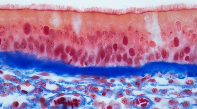 alt= Light micrograph (LM) of a vertical section through the pseudostratified columnar epithelium from the trachea, the tube in the throat leading from the mouth to the bronchus and the lungs